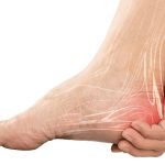 Why you're experiencing heel pain and what you can do to prevent and treat it